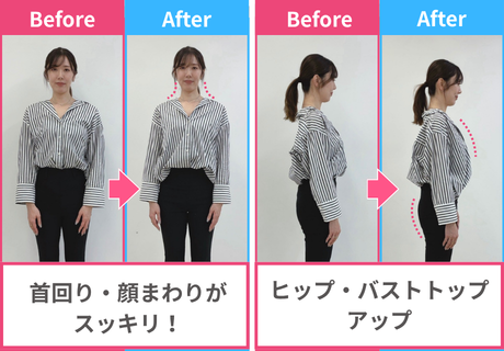 背述後ビフォーアフター画像